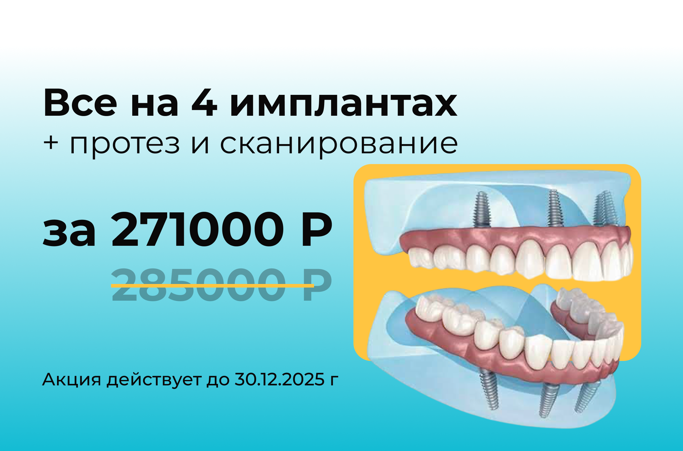 Акция 2