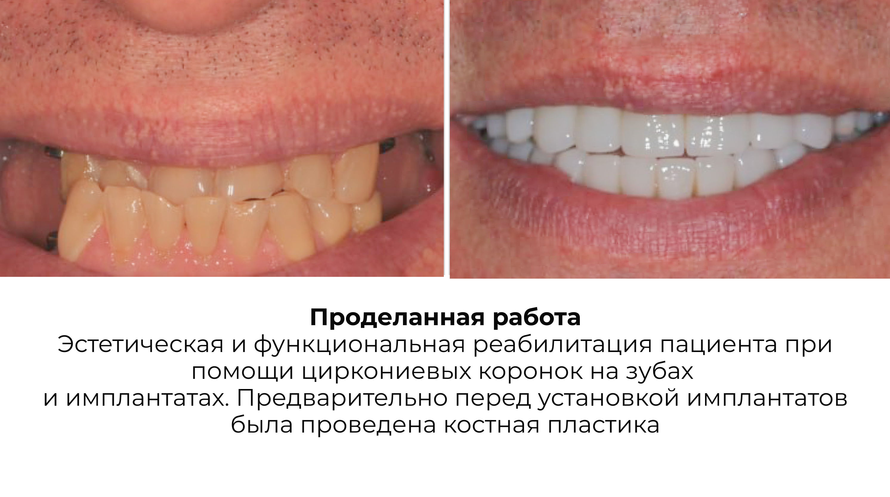 Работа 4